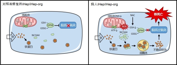 線粒體疾病肝細(xì)胞的全新鐵死亡模式、細(xì)胞器互作機(jī)制